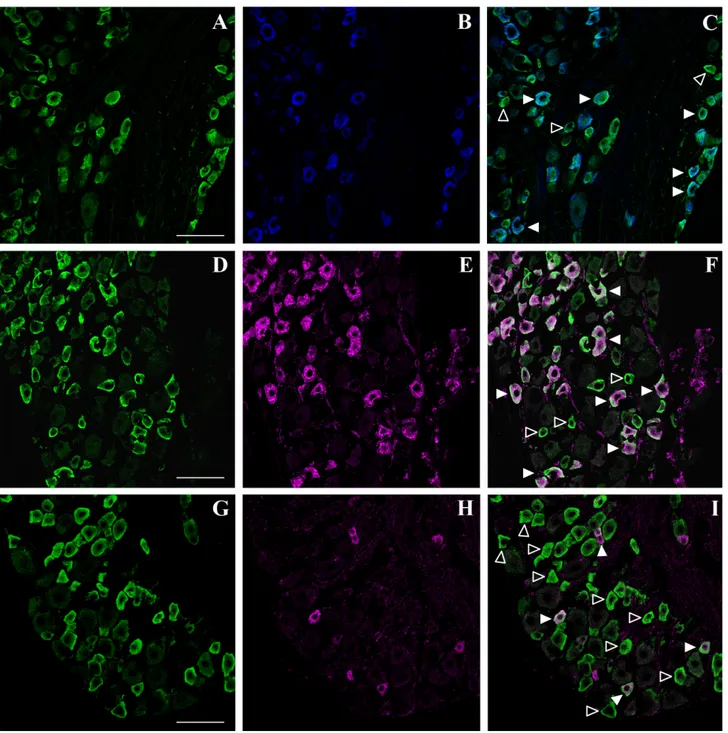 Fig. 3. Phenotypic characterization of doublecortin (DCX)- (DCX)-expressing cells in the adult mouse dorsal root ganglia (DRG) by confocal microscopic analysis