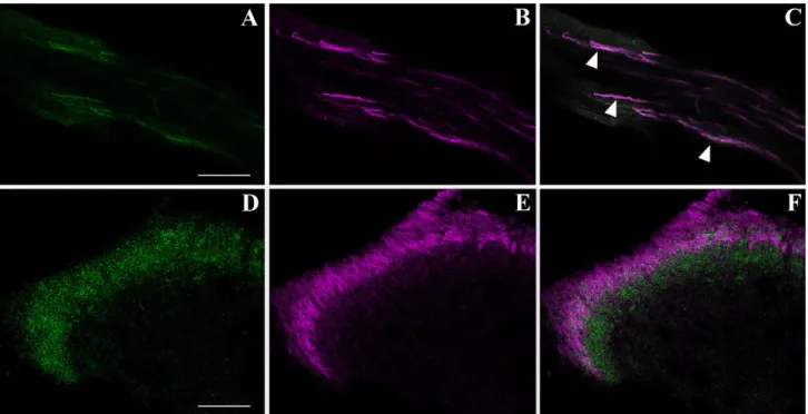 Fig. 4. Phenotypic characterization of doublecortin (DCX)-positive ﬁbers centrally projecting to the mouse spinal cord (SC) dorsal horns by confocal microscopic analysis