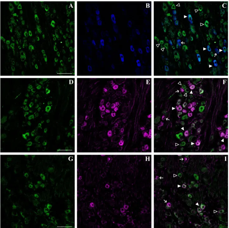 Fig. 5. Phenotypic characterization of doublecortin (DCX)- (DCX)-expressing cells in the adult rat dorsal root ganglia (DRG)