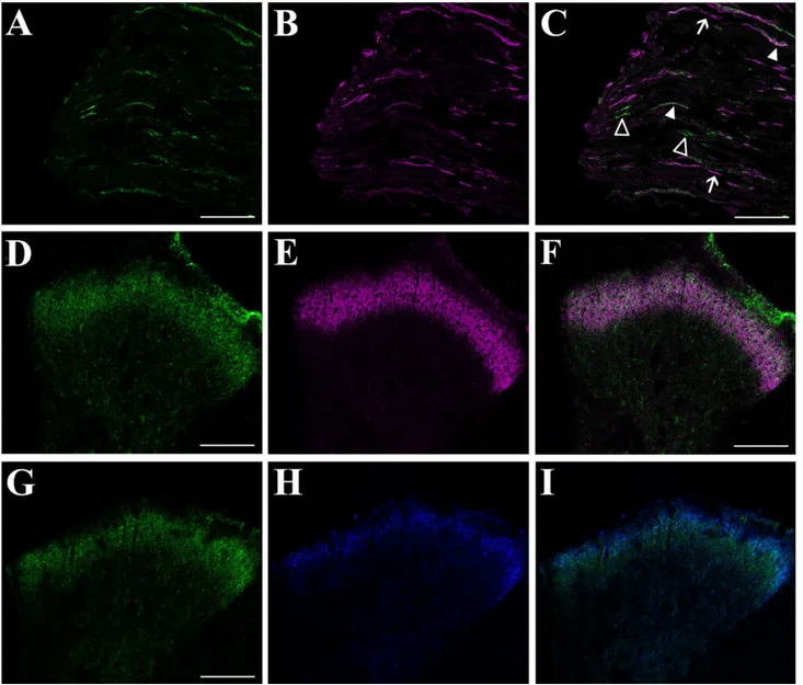 Fig. 6. Phenotypic characterization of doublecortin (DCX)-positive ﬁbers centrally projecting to the rat spinal cord (SC) dorsal horns by confocal microscopic analysis