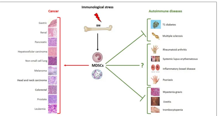 FIGURE 2 | Schematic role of MDSCs in pathology. Immunological stress induces the expansion of MDSCs that play different roles depending on distinct pathological and microenvironmental contexts