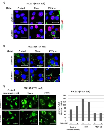 Figure 8: Effect of ectopic expression of PTEN in FTC133 cells on the cellular expression of GLUT1 and LC3 and on 