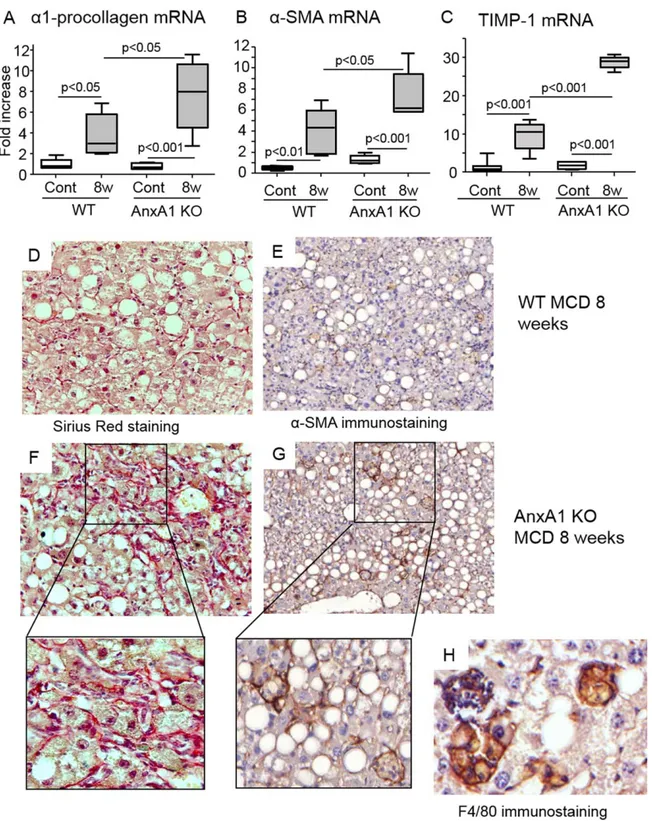 Fig. 6. AnxA1 deficiency promotes hepatic fibrosis in mice with NASH. WT and AnxA1 KO C57BL/6 mice were fed the MCD diet for 8 weeks
