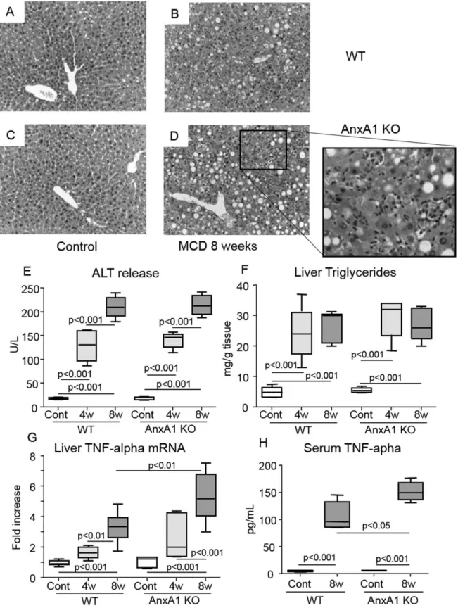 Fig. 3. AnxA1 deficiency promotes steatohepatitis in mice with NASH. WT and AnxA1 KO C57BL/6 mice were fed the MCD diet up to 8 weeks