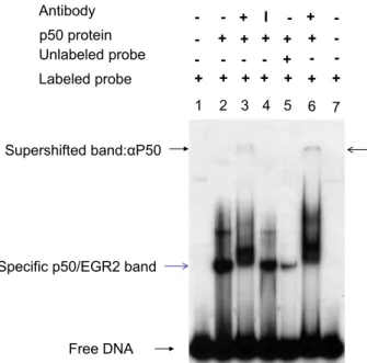 Fig. 6. p50 protein speciﬁcally binds to a regulatory element within the Egr-2 promoter in vitro EMSA demonstrates binding of recombinant p50 to Egr-2 promoter region IV  oli-gonucleotides containing a putative NF-κB binding site in vitro