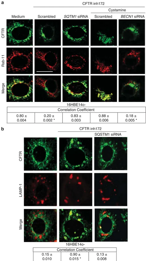 Figure 6 Functional inhibition of CFTR impairs CFTR recycling in bronchial epithelial cells