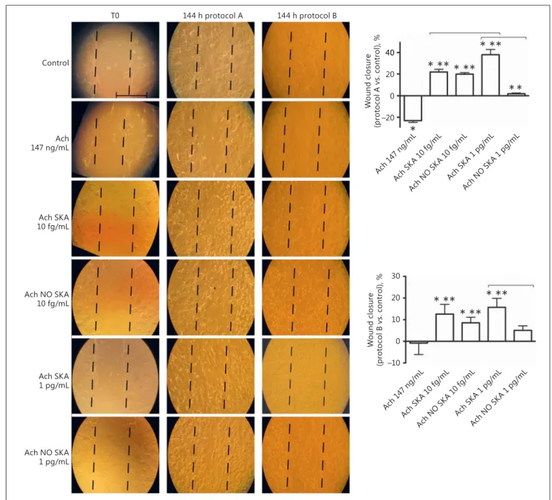 Fig. 2.   Involvement of different formulations of Ach in NHEK 