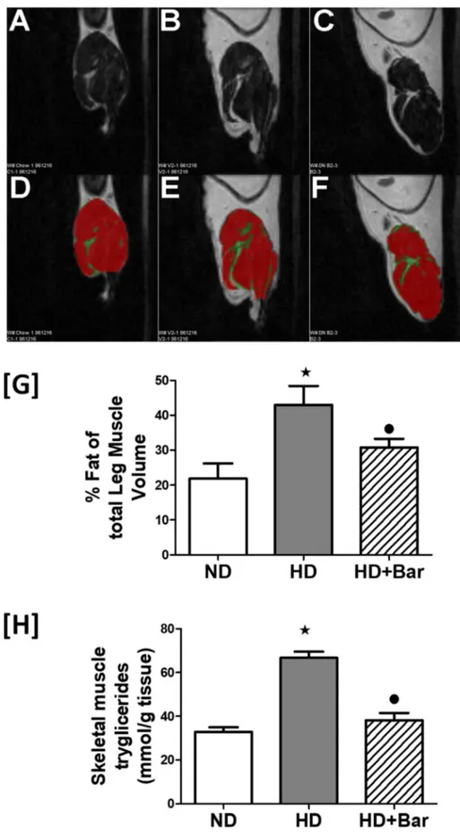 Figure 5: MRI analysis of the quadriceps muscle (A, B, C, D, E and F). Effects of HD and baricitinib administration on fat deposition in the skeletal muscle (G) and skeletal muscle triglyceride levels (H)