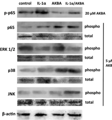 Fig. 3. Gelatinolytic activity of MMP-9 in HaCaT cells, after 48 h treatment with B. serrata extract (panel A) or AKBA (panel B), with and without stimulation with 10 ng/ml IL-1α (grey and white bars, respectively)
