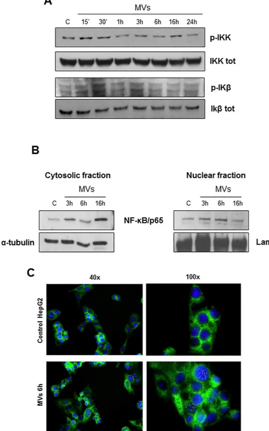 Fig 5. MVs up-regulate NF-KB pathway. A. Western blot analysis of activation of IKK and IKβ evaluated in total extracts of HepG2 naïve cells exposed to MVs for indicating time