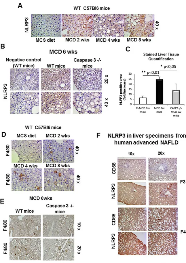 Fig 2. Immunohistochemistry analysis for NLRP3 and F4/80. A,B. Immunohistochemistry analysis for NLRP3 on liver specimens from WT mice fed with MCS diet or MCD diet for 2wks, 4wks and 8wks (A) as well as WT mice and Casp 3  -/-knockout mice fed for 6wks (B