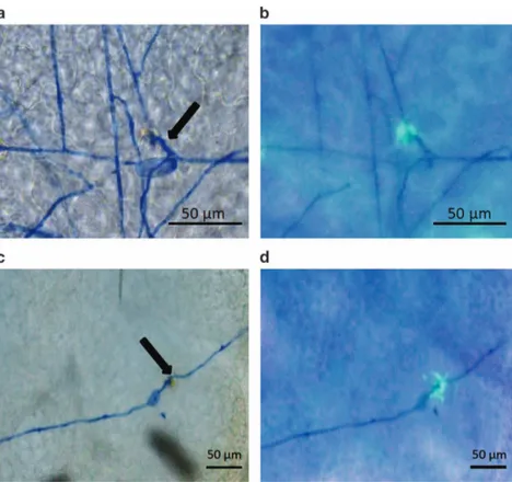 Figure 3. Microscopic visualization of powdery mildew infection in the control line EVB (a, b) and in the resistant transgenic line TLB4 (c, d)
