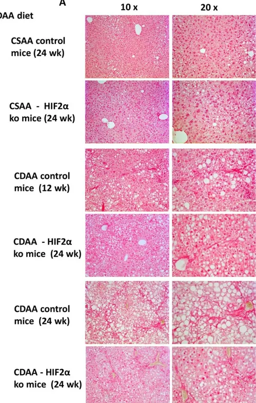 FIG. 4. Liver ﬁbrosis “in vivo” in hHIF-2a –/– mice versus littermate mice fed the CDAA diet
