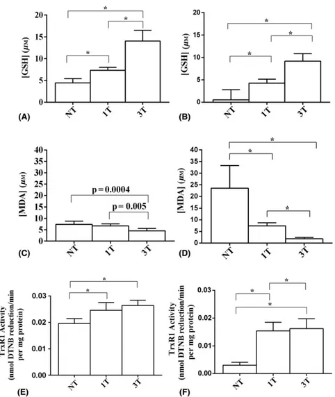 Fig. 3. Eﬀects of SMPL on glutathione (GSH), malonyldialdeide (MDA) and thioredoxin reductase 1 (TrxR1) retinal content in young (A, C, E) and old (B, D, F) mice