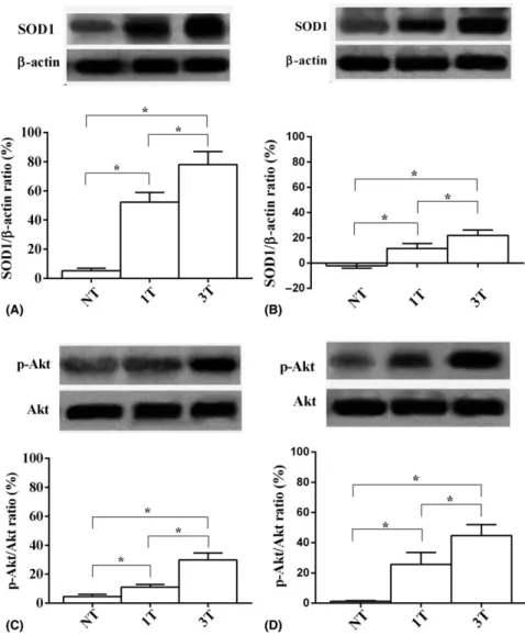 Fig. 5. Eﬀects of SMPL on retinal superoxide dismutase 1 (SOD1) and Akt activation in young (A, C) and old (B, D) mice