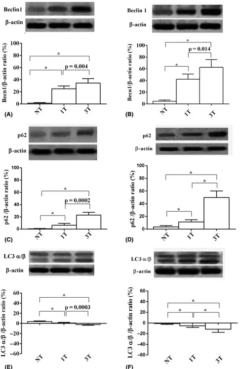 Fig. 8. Eﬀects of SMPL on retinal autophagy in young (A, C, E) and old (B, D, F) mice