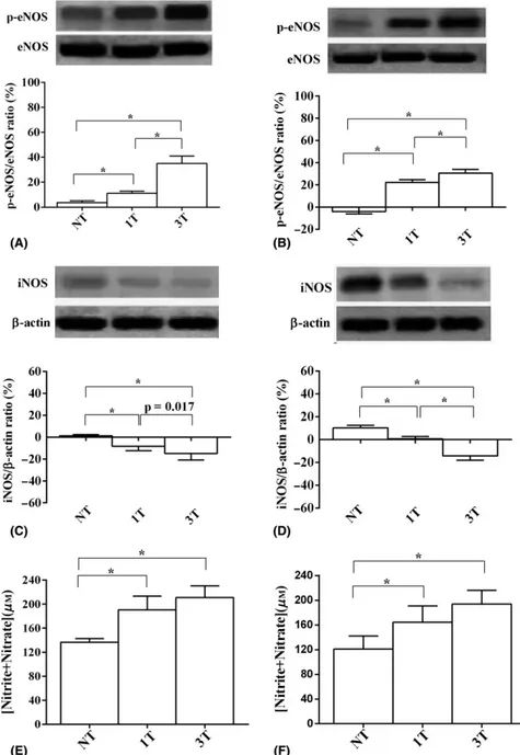 Fig. 9. Eﬀects of SMPL on retinal nitric oxide synthase (NOS) content and nitrate and nitrite production in young (A, C, E) and old (B, D, F) mice