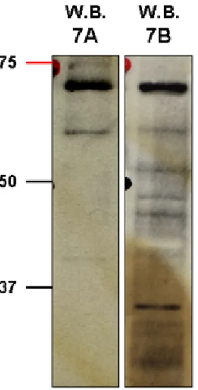 Figure 1.1. Identification of HOXC13 protein in human cells by immunoblotting. Western 