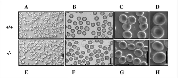 Figure  1.10:  Morphology  of  RBCs.  Native  (A  and  E  Panels)  and  May-Gruenwald  Giemsa  stained  (B 