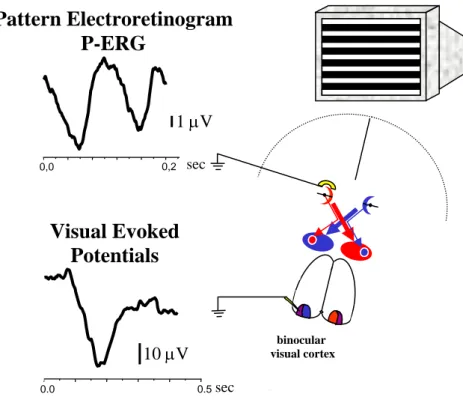Figure 2: Schematic representation of P-ERG and VEP recordings 