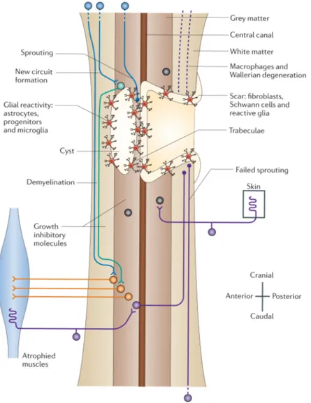 Figure 3. Diagram representing the spinal cord at the chronic stage of injury (adapted from Thuret et al., 2006)