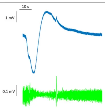 FigURe 1 | Full-band (DC-coupled) recordings of spreading depression. Two  events propagate across the full electrode strip from electrodes 6 to 1, as  shown by negative DC shifts and 0.5–50 Hz depressions of spontaneous  activity