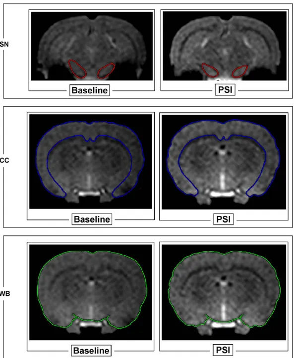 Figure 1. Coronal images of brain areas of a representative PSI-treated animal by using T 2 *-weighted gradient-echo sequences
