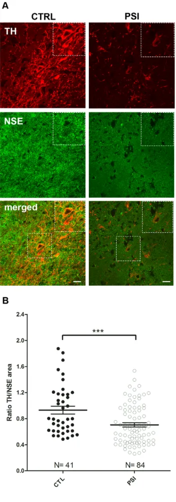 Figure 7. Immunofluorescence analysis. Panel A: Representative images of samples from control (CTL) and PSI (PSI) treated rats