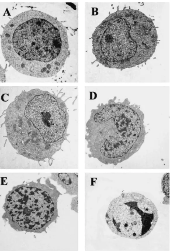 Fig. 1. Ultrastructural analyses of DMSO-treated cells. Untreated cells (A), 8 h (B), 12 h (C), 24 h (D), 48 h (E) and 72 h (F)  DMSO-treated cells