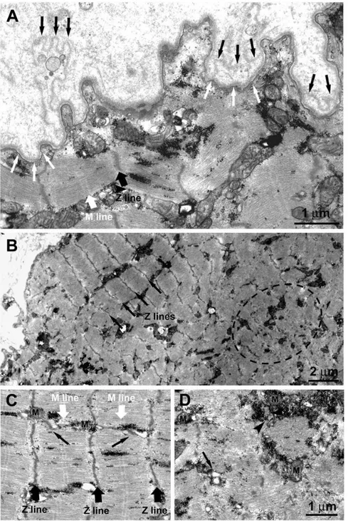 Figure 11.  1.4-year  Human  Denervation.  Ultrastructural  features  of  a  muscle  fiber  undergoing  atrophy  due  to  lack  of  innervation