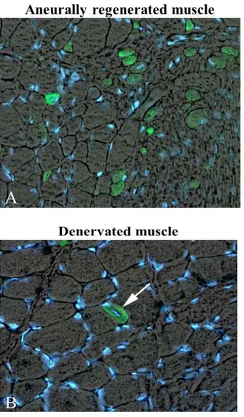 Fig 5.  Marcaine induced muscle fiber regene-ration in  denervated  rat  soleus  30  days  after  bilateral  sciatectomy  and  unilateral  marcaine-induced  muscle  damage  