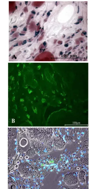 Fig 7.  Four-year LMN human denervated quadriceps  muscle.  Immunohistochemical  staining  with  anti-MHCslow  shows  that  both  the   green-labeled slow type muscle fibers (white arrows)  and  the  fast  (larger,  not  stained  muscle  fibers  noted  by 