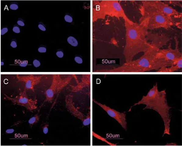 Fig. 1 BM-hMSCs by indirect immunofluorescence (Rhodamine). Cultured cells were positive for the mesenchymal stem cell marker CD73 (A),  CD90 (C), CD105 (D) and negative for the hematopoietic markers CD34 (A)