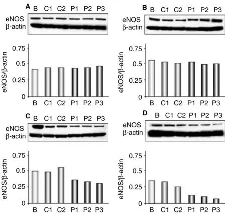 Fig. 1. Representative protein blotting of eNOS and b-actin after 3 hours (A), 6 hours (B), 18 hours (C), and 24 hours (D) of  HU-VEC stimulation with basal medium ( , B), RBC from healthy controls ( , C1, C2), or RBC from ESRD patients ( , P1, P2, P3)