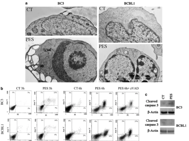 Figure 2 Features of PES-induced cell death. (a) BC3 and BCBL1 cells untreated or PES-treated (20 mM) were analyzed by electron microscopy after 24 h of treatment (Bar 1 mm; N, nucleus)