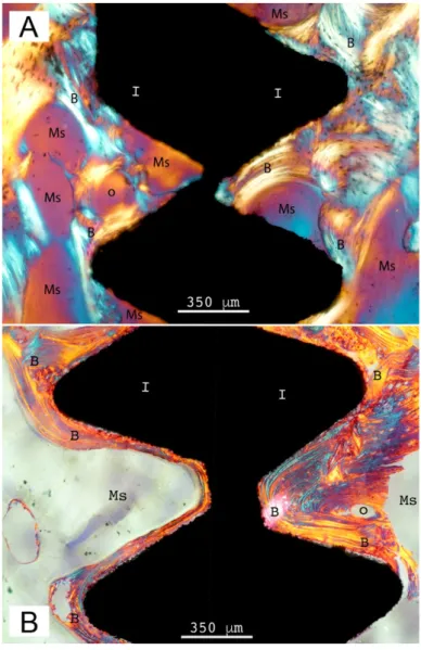 Figure 8. Histological sections of fractured implants under circularly polarized light microscope