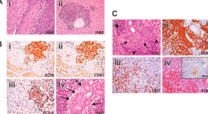 Figure 3. Development of multiorgan lymphoid infiltrates in Il12rb2 KO mice. (A) Liver from a 15-month-old Il12rb2 KO