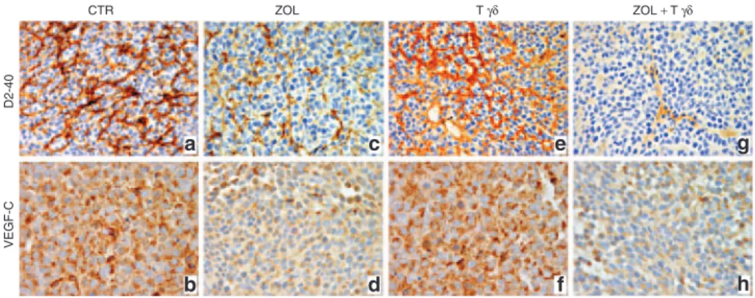 Figure 5  Lymphatic vessel network and VEGF-C expression in tumors developed in mice that after orthotopic engraftment of SH-SY-5Y cells  received treatments with ZOL and/or human Vγ9Vδ2 T cells