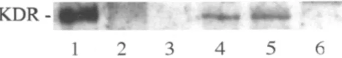 Fig. 1. Expr ession o f KDR and VEGF mRN A ex pression in M0 7 , HEL and B164 7 ce lls b y RT-PCR 