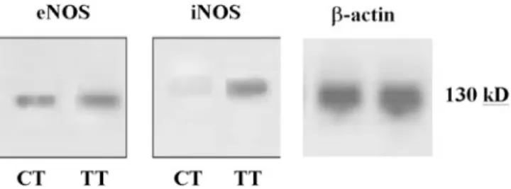 FIGURE 5. Western blot analysis for eNOS and iNOS in the TT and