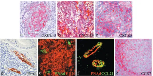 Fig. 3. Immunohistochemical evidences of lymphocyte homing chemokine-receptor system and PNAd expression in PALT LFs