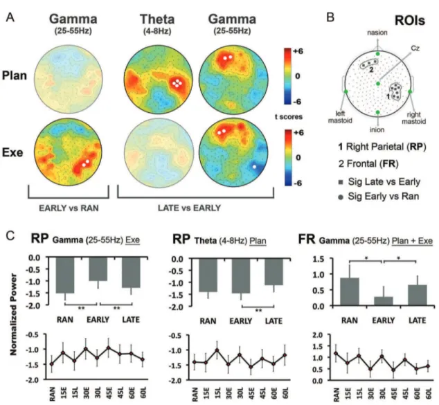 Figure 3. Spectral power analysis. A, Statistical nonparametric mapping analysis comparing EARLY ROT with RAN and LATE ROT during movement planning (Plan, 250 ms before movement onset) and movement execution (Exe, 250 ms after movement onset)