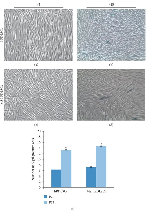 Figure 7: Cellular senescence assessment. hPDLSCs (a) and MS-hPDLSCs (c) at P2 showed a basal staining for X-gal blue solution, while signi ﬁcant positive staining was observed in hPDLSCs (b) and MS-hPDLSCs (d) at P15