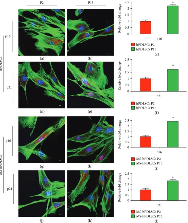 Figure 8: Senescence markers p16 and p21 expression. Immunoﬂuorescence staining of p16 in P2 and P15 hPDLSCs ((a) and (b), resp.) and p21 in P2 and P15 hPDLSCs ((d) and (e), resp.)