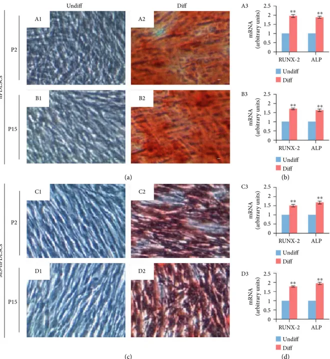 Figure 3: Osteogenic diﬀerentiation potential of hPDLSCs collected from healthy donors and MS patients