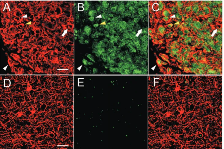 Figure 6. Confocal microscopy images of GFAP (red) and TAZ (green) expression in ET and BAT
