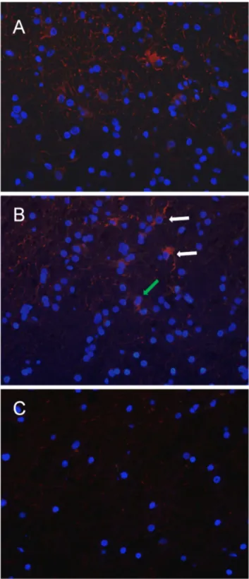 Figure 8. Immunofluorescence of CD133 expression in ET, BAT and CTRL. CD133 cytoplasmic immunopositivity (red) was observed in a moderate number of cells in the ET (A)