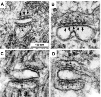 FIGURE 2 Images of single CRUs showing the presence of feet (on opposite side of the jSR membrane from the tips of arrows) in wild-type (A) and dysgenic mice (B) and their absence in dyspedic (C) and double knock out (D) mice