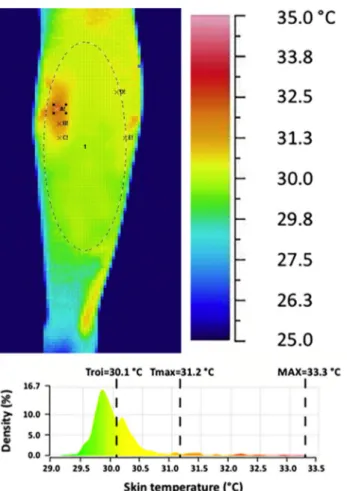 Fig. 4. Thermal image and relative frequency distribution of temperature pixels within the ROI in a female athlete participating in the experimental study described in Formenti et al