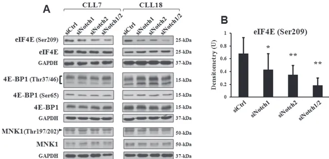 Figure 4: Mcl-1 downregulation by Notch silencing is associated with reduced phosphorylation of eIF4E
